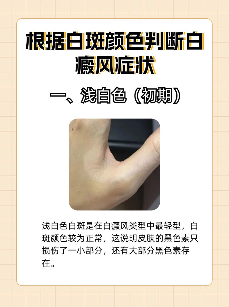 在选择皮肤科医院时，你是否感到迷茫？如何才能找到最适合自己的医院呢？今天，就让我们一起来看看几家备受好评的皮肤科医院吧！