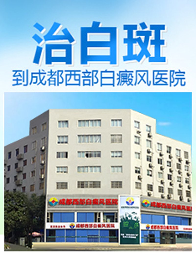 成都白癜风医院
