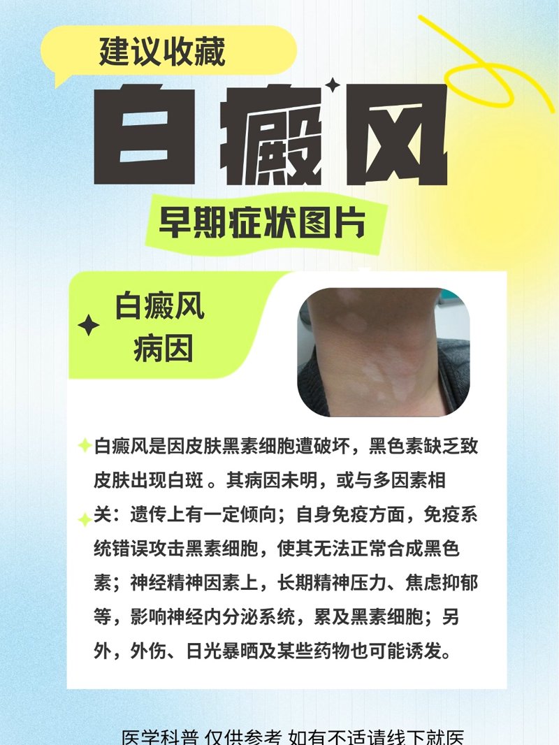 最近，李女士因为皮肤上出现了一些白斑，被确诊为白癜风。她非常担心治疗的费用问题，特地询问了成都西部白癜风医院的专业医生。