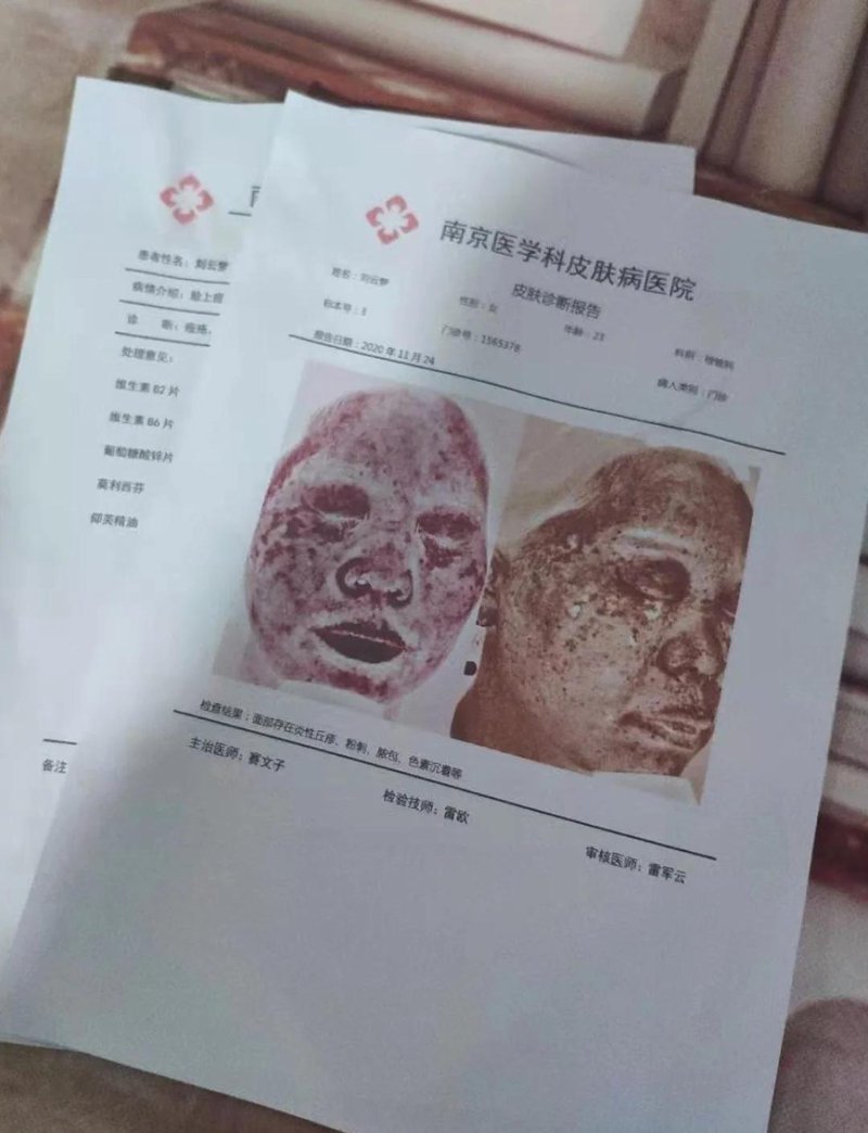 成都西部白癜风医院:国丹守护,专治白癜风
