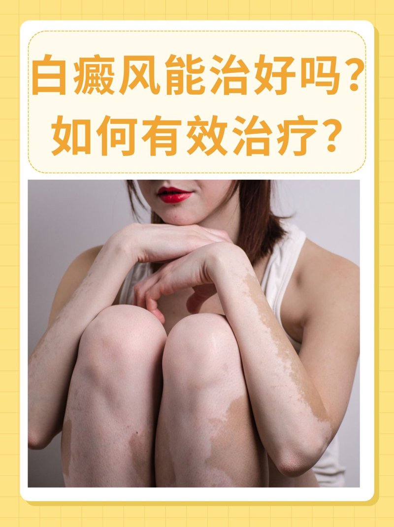 在选择皮肤科医院时，如何做出明智的选择？今天就带你看看成都市内几家知名的皮肤科医院，帮你找到最适合的那一家。